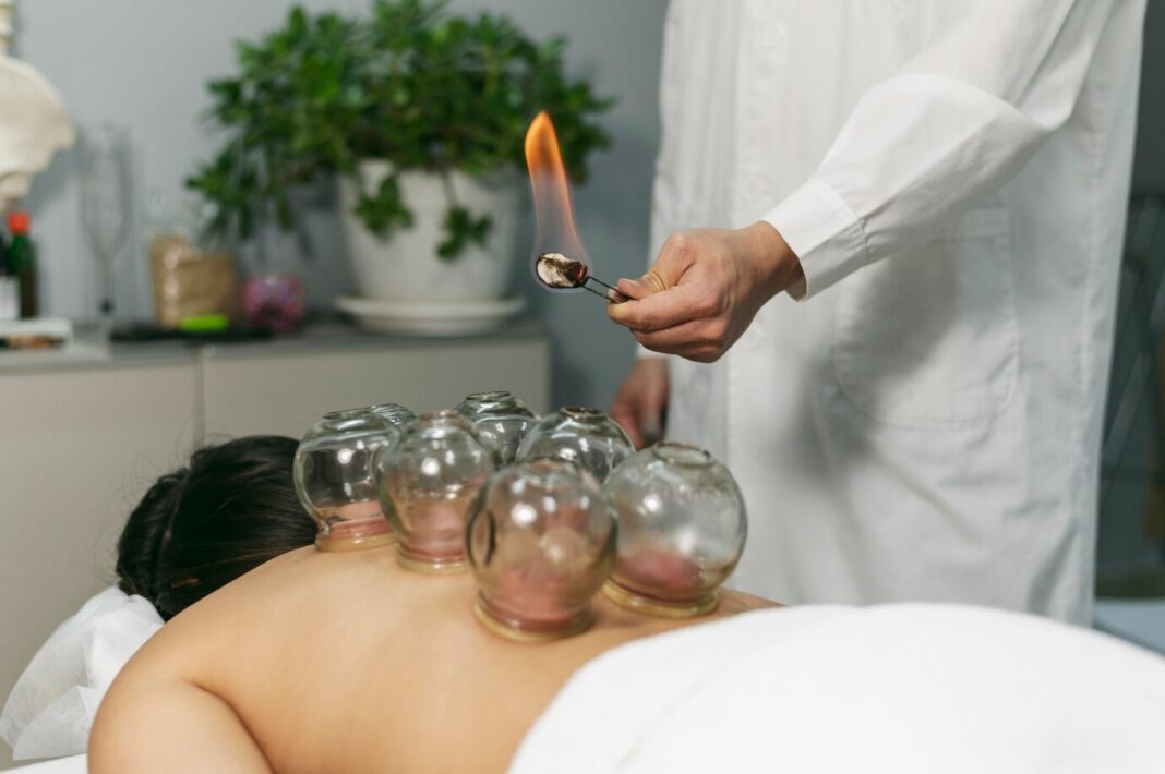 cupping massage near me